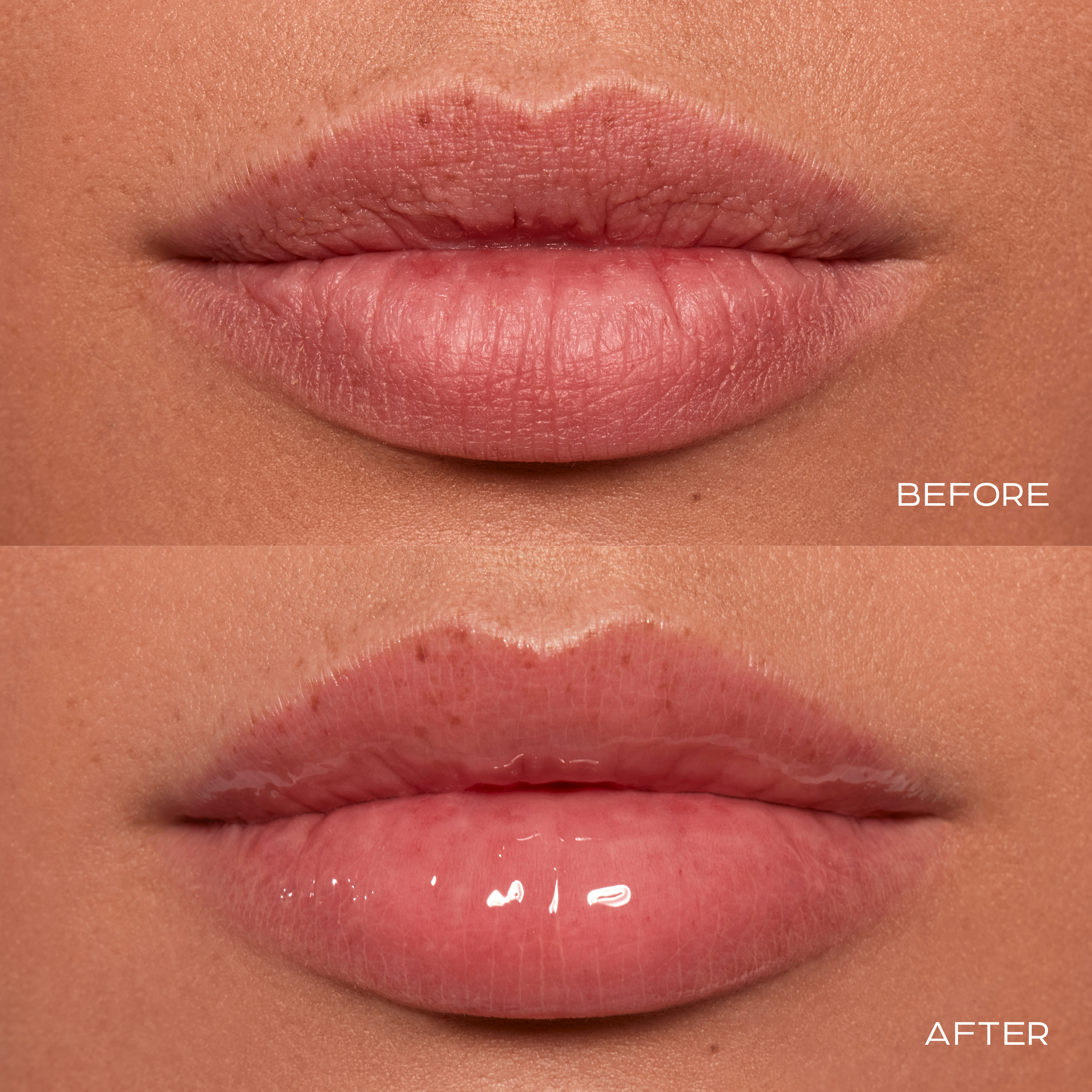 HYALURONIC_5_f94087cf-843f-4eab-b54f-a41c957432b8.png